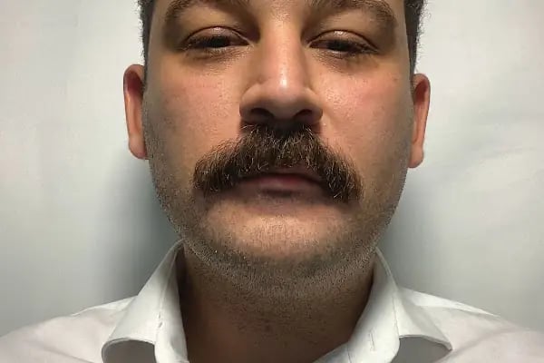 Beylikdüzü Klinik Psikolog Alper Demir - Resim 5