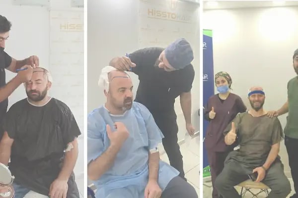 İzmir Saç Ekimi Merkezi - Hisstohair | Fue saç ekimi | PRP ve Mezoterapi | Sakal ekimi | Kaş ekimi - Resim 2