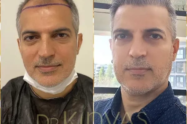 drkinyashairclinic - Resim 7
