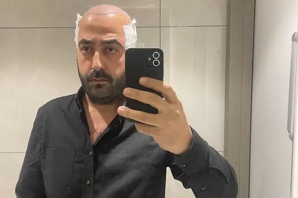 NeoHair Plus Saç Ekimi - Resim 3