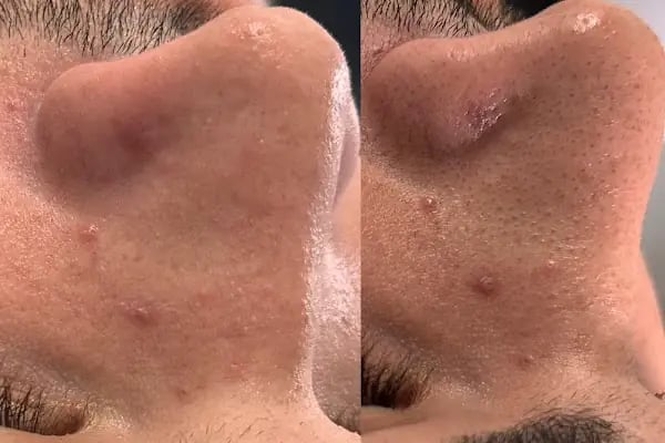 SERA BEAUTY GÜZELLİK SALONU - Resim 13