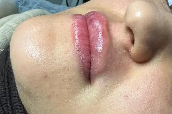 Hülya Yılmaz Beauty (Lazer Epilasyon, Cilt Bakımı, Kalıcı Makyaj, Microblading) - Resim 4