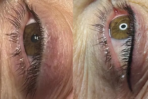 Hülya Yılmaz Beauty (Lazer Epilasyon, Cilt Bakımı, Kalıcı Makyaj, Microblading) - Resim 2