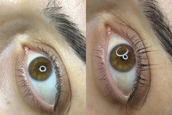 Hülya Yılmaz Beauty (Lazer Epilasyon, Cilt Bakımı, Kalıcı Makyaj, Microblading) - Resim 7