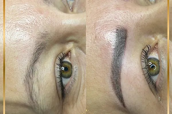 Hülya Yılmaz Beauty (Lazer Epilasyon, Cilt Bakımı, Kalıcı Makyaj, Microblading) - Resim 20