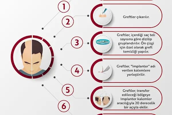 Uğur Taner Saç Ekimi - Resim 2