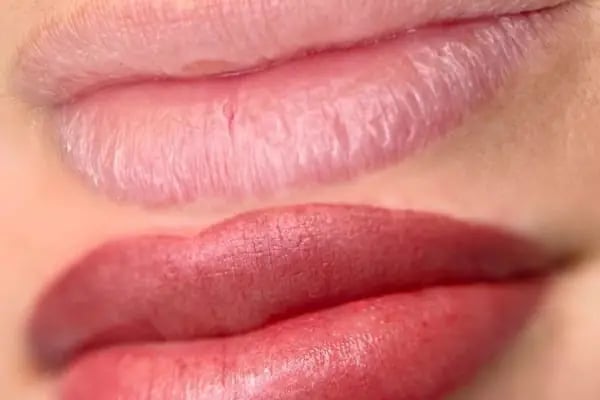 Bera Beauty Center | Güzellik Merkezi - Resim 13