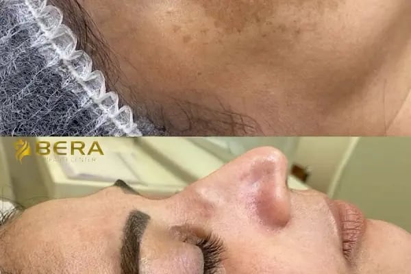 Bera Beauty Center | Güzellik Merkezi - Resim 15