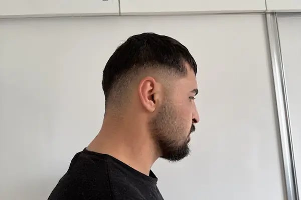 One Hair Clinic Transplantation - Plastic Esthetic - Resim 3