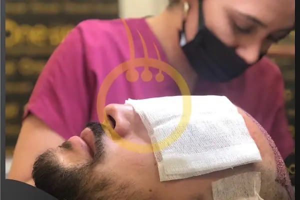 One Hair Clinic Transplantation - Plastic Esthetic - Resim 20