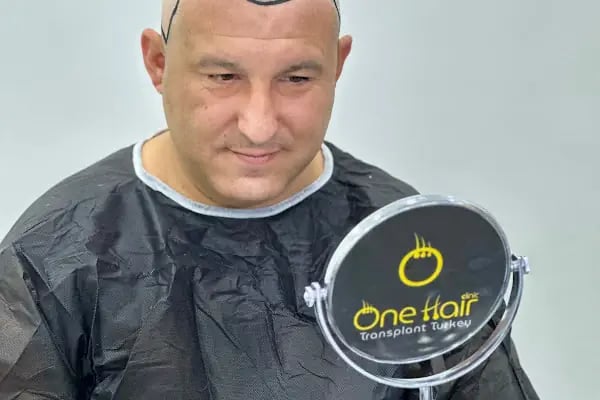 One Hair Clinic Transplantation - Plastic Esthetic - Resim 14