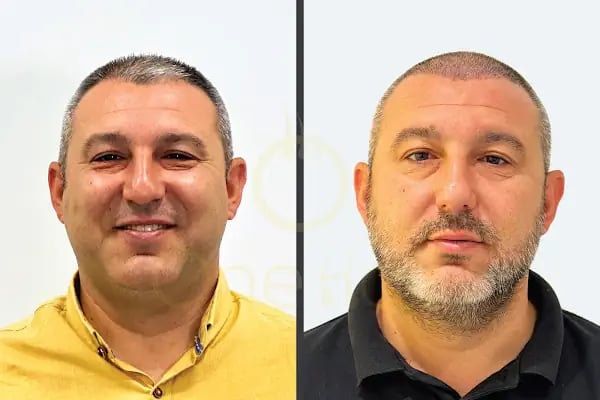 One Hair Clinic Transplantation - Plastic Esthetic - Resim 18