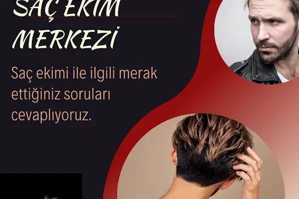 Ankara Hastane Göz Kapağı Estetiği ,Saç Ekimi , Sağlık Danışmanlık - Resim 17
