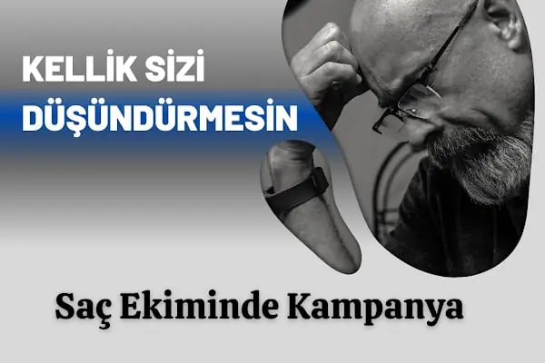Ankara Hastane Göz Kapağı Estetiği ,Saç Ekimi , Sağlık Danışmanlık - Resim 18