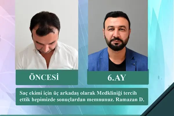Medklinik Konya Saç Ekimi Merkezi - Resim 18