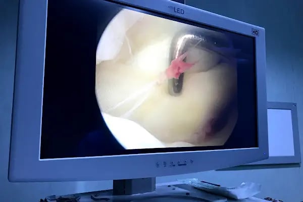 Dr. Burak Önvural, Spor Yaralamaları ve Ortopedi Kliniği - ONVortho Orthopedic Clinic Turkey - Resim 13