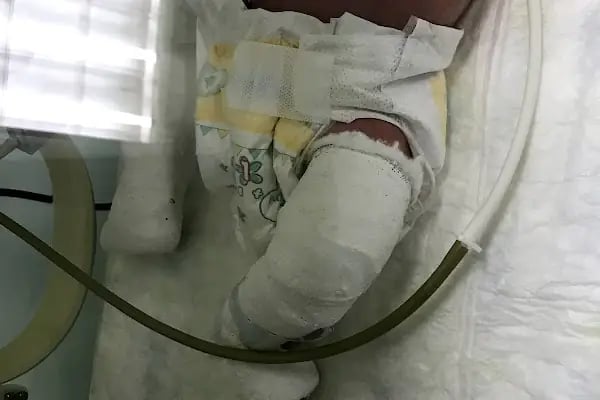 Dr. Burak Önvural, Spor Yaralamaları ve Ortopedi Kliniği - ONVortho Orthopedic Clinic Turkey - Resim 16