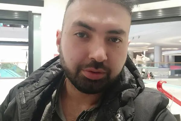 AY - ÇA | Saç Ekimi | Estetik | Lazer Epilasyon Antalya - Resim 8