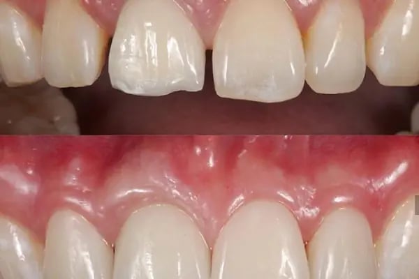 Denti Delil Ağız ve Diş Sağlığı Polikliniği Bağcılar şubesi - Resim 2