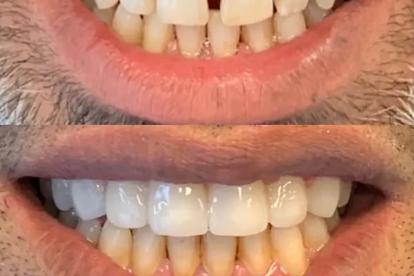 Doç Dr Murat Metin Ağız Diş Çene Cerrahisi Ve İmplant Kliniği - Resim 18