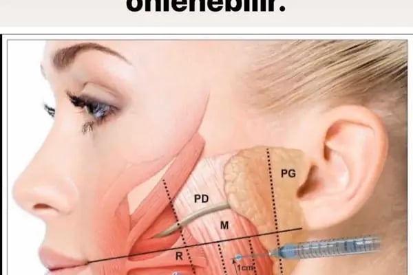 Doç Dr Murat Metin Ağız Diş Çene Cerrahisi Ve İmplant Kliniği - Resim 10