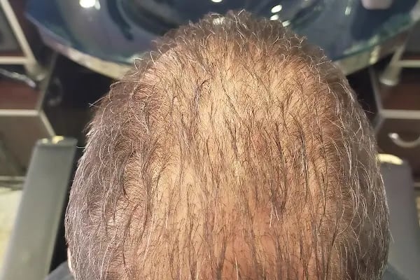 Mgr KUAFÖR barber - Resim 15