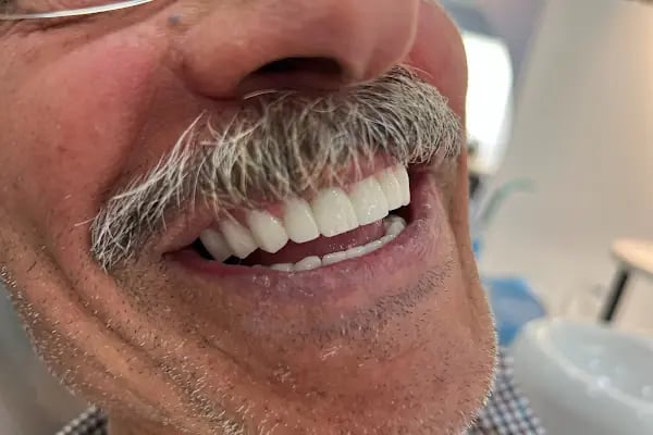 Özel Döşemealtı Ağız ve Diş Sağlığı Polikliniği - Resim 5