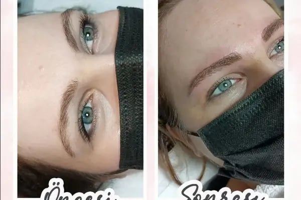 Estedore Beauty Palace Maltepe | Epilasyon, Cilt Bakımı, Zayıflama - Resim 18