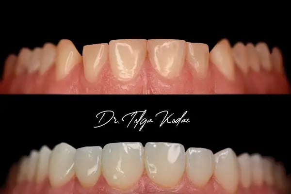 Dr. Dt. Tolga Kodaz, Diş Hekimi - Resim 19