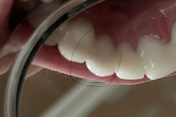 Özel Elvankent Ağız Ve Diş Sağlığı - Resim 8