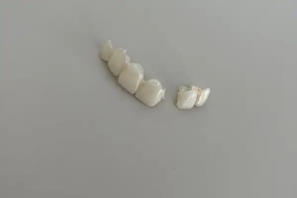 Özel Elvankent Ağız Ve Diş Sağlığı - Resim 3