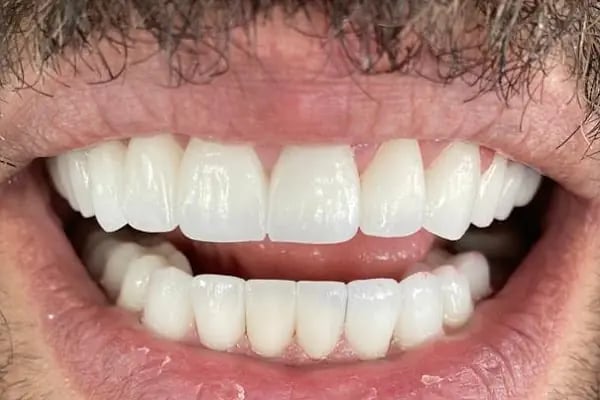 Focus Dental Clinic | Implant &amp; Smile Design Center | İmplant &amp; Gülüş Tasarımı Merkezi - Resim 15