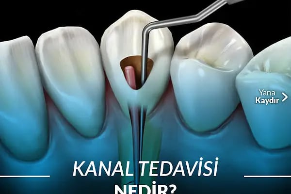 Özel Ensar dent Ağız ve Diş Sağlığı Polikliniği - Resim 11