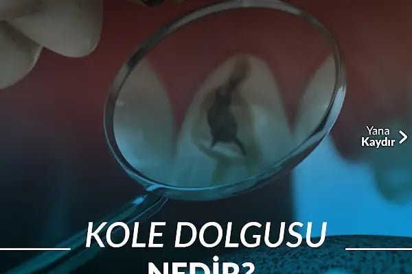 Özel Ensar dent Ağız ve Diş Sağlığı Polikliniği - Resim 15