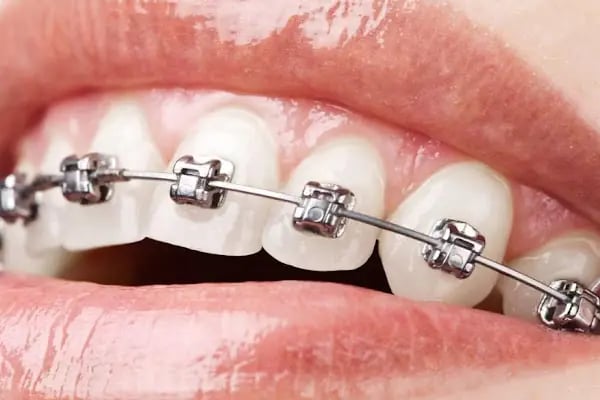 Vera Dental Clinic - Resim 5