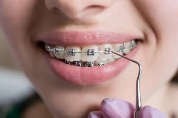 Vera Dental Clinic - Resim 6