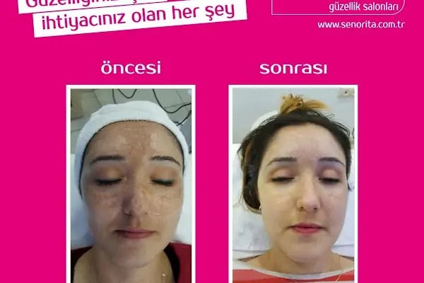 Senorita Avcılar - Resim 16
