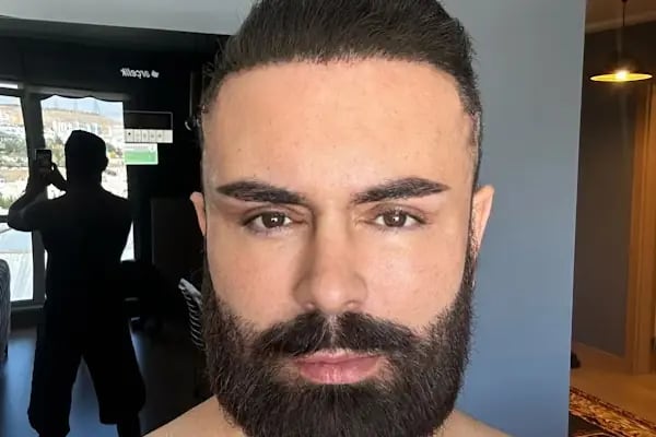 Op. Dr. Fatih Burak Efeoğlu - Resim 5