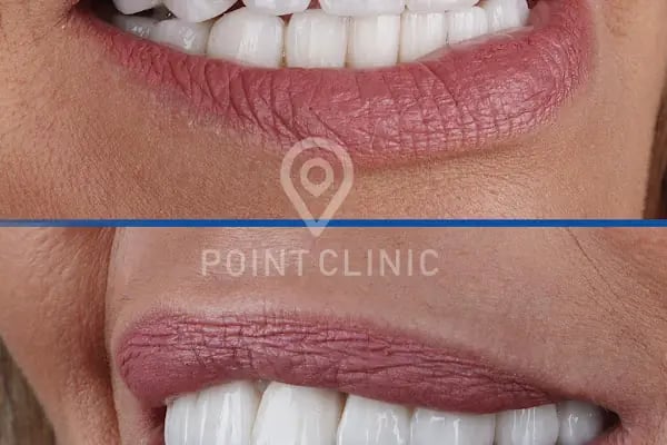 Point Dental Clinic - Resim 13