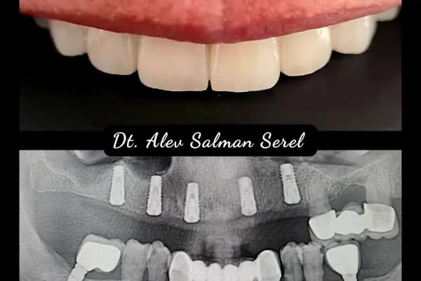 Diş Hekimi ALEV SALMAN SEREL - Resim 17