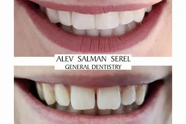 Diş Hekimi ALEV SALMAN SEREL - Resim 18
