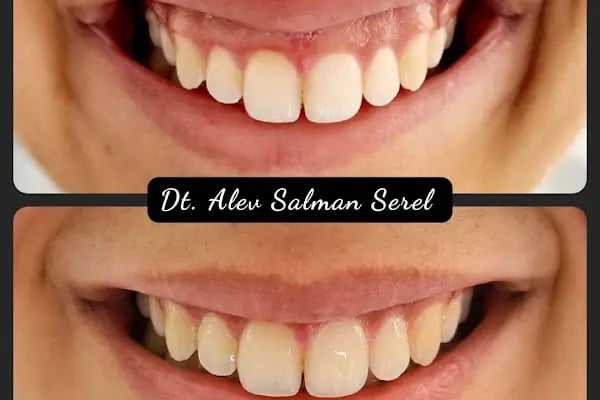Diş Hekimi ALEV SALMAN SEREL - Resim 16