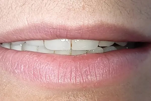 Özel Altındağ Ağız ve Diş Sağlığı Polikliniği - Resim 9