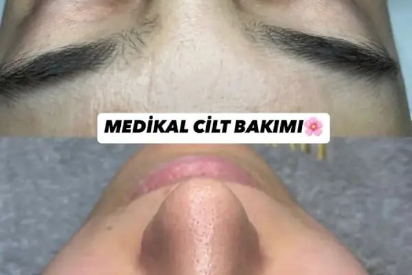 Sevda Güzellik Salonu - Resim 8