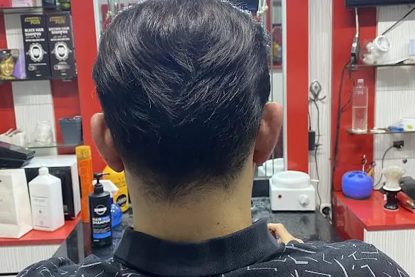 Serkan Aydin Hair Transplant - Resim 11