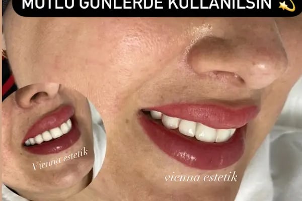 CK VİENNA GÜZELLİK SALONU - Resim 15