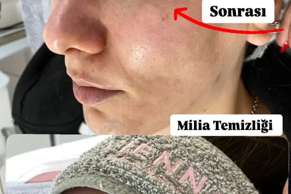 CK VİENNA GÜZELLİK SALONU - Resim 20