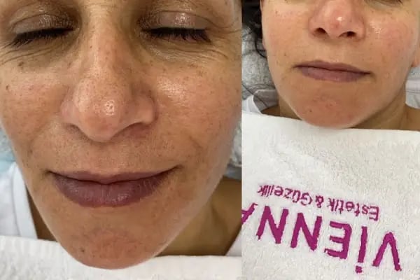 CK VİENNA GÜZELLİK SALONU - Resim 16