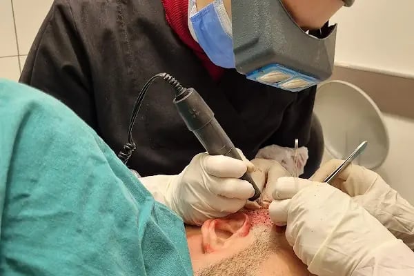 Клиника по пересадке волос Анталья VIVAEST - Saç Ekimi - Hair Transplant Antalya - Resim 8