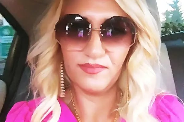 Sakarya sac kaynak Şahin Eroğlu Saç Kaynak merkezi - Resim 15